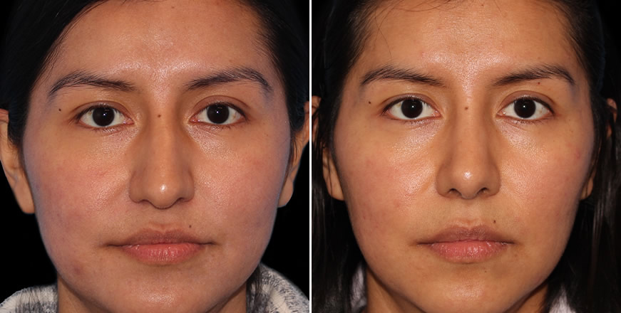 Plastic Surgery Results